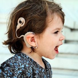 Cochlear's profit dented by US tax charges but Apple's implant project is steaming ahead