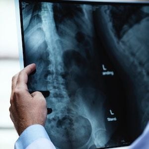 Capitol Health drops $8.1 million on Melbourne radiology network