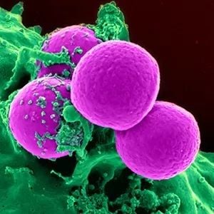 Mesoblast secures US stem cell treatment trial for Covid-19
