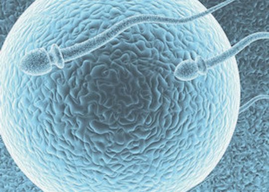 Monash IVF to raise $80 million as elective surgery ban is lifted
