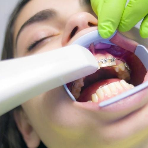 NAB tightens the screws on Smiles Inclusive