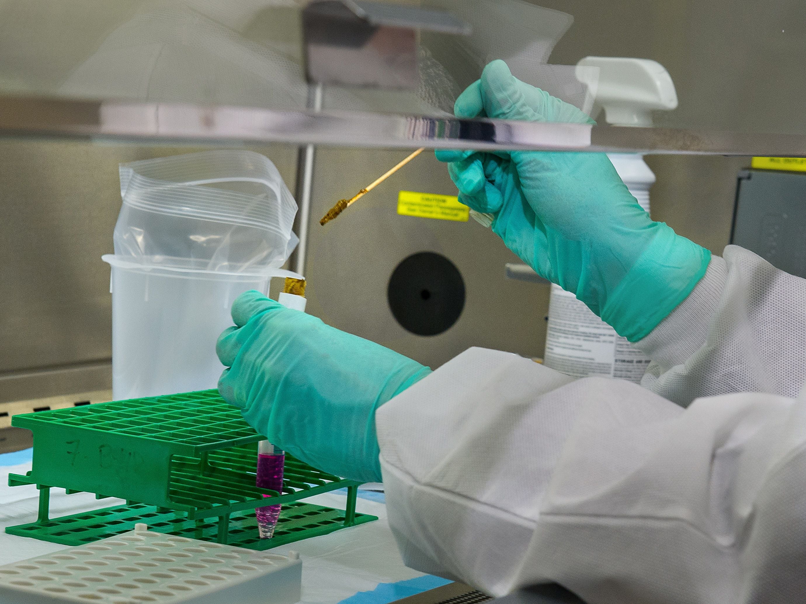COVID testing demand means record result for Sonic Healthcare, but market sniffles on outlook