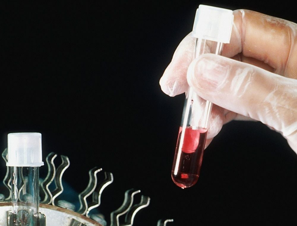 IDT Australia sweetens pot for potential suitor Myndbio as revenue surges 92pc