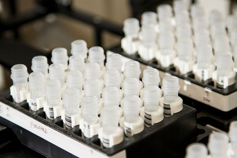UK biotech group Molecule to Medicine backs UQ startup Curlew Bio in hunt for a new Spinifex