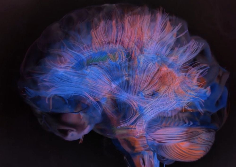 NRFC pumps $20m into Sydney brain mapping scale-up Omniscient Neurotechnology