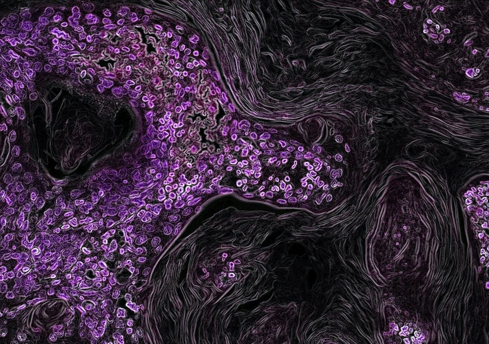 Clinical-stage biotech Racura Oncology raises $34.3m to fully fund three cancer drug trials