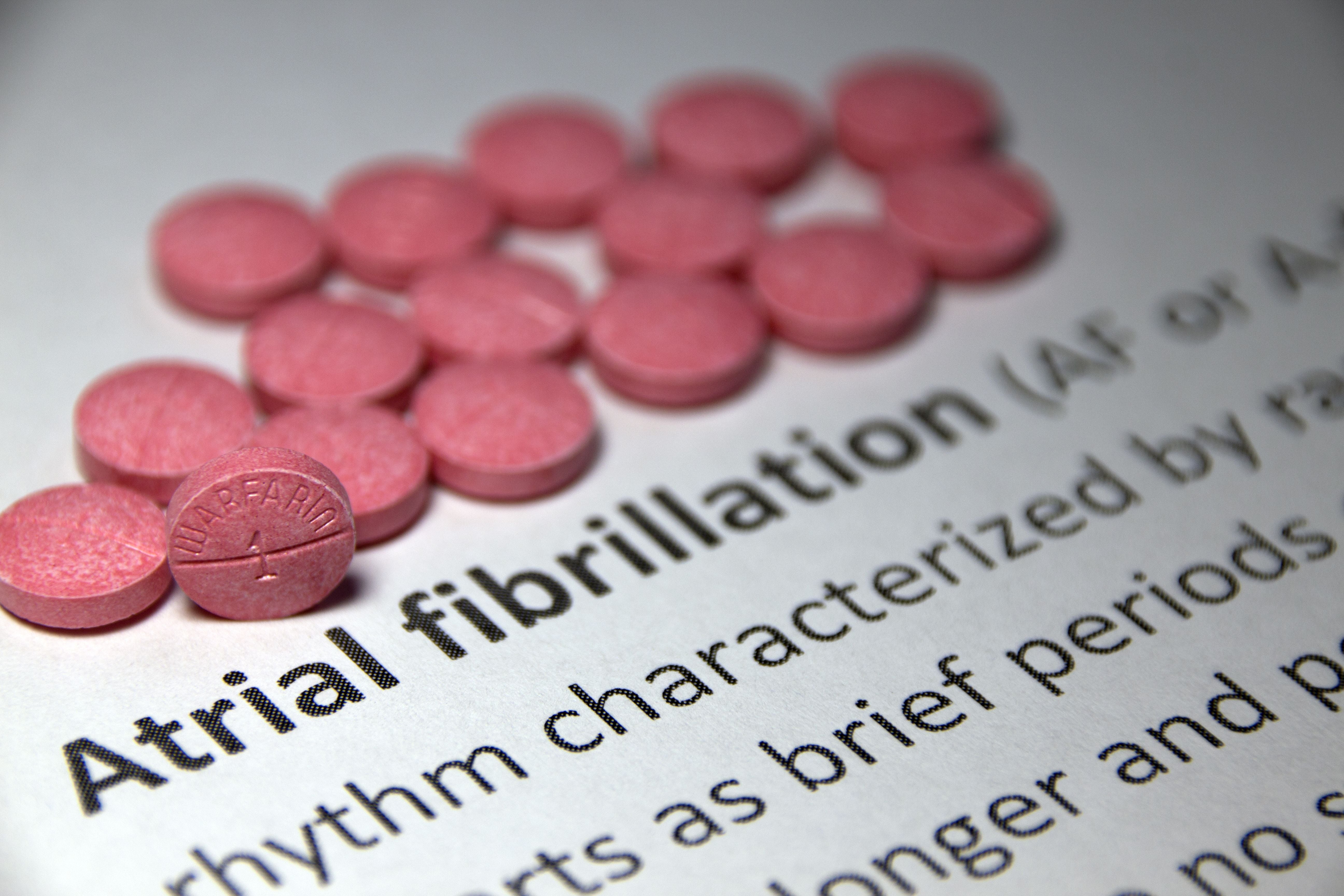 Atrial fibrillation: Does it ever go away?