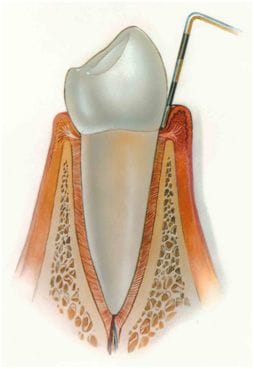Periodontics & Dental Implant Centre | Periodontics | Indoor
