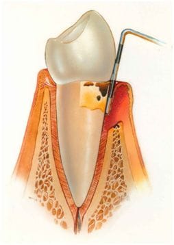 Periodontics & Dental Implant Centre | Periodontics | Indoor