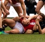 2018 Elimination Final vs North Adelaide Image -5b8be99a25218