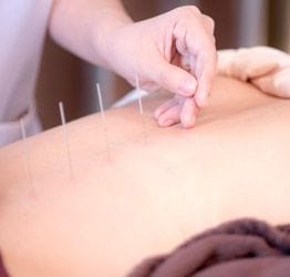 Mississauga Chiropractic Clinic Treats Acupuncture