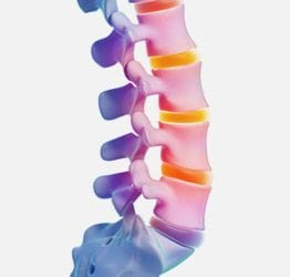 The Advantages of Non-Surgical Spinal Decompression Therapy