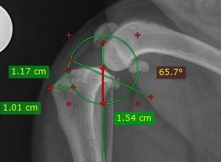 TPLO Surgery for Ruptured Cruciate Ligament in Dogs - Gold Coast and Brisbane