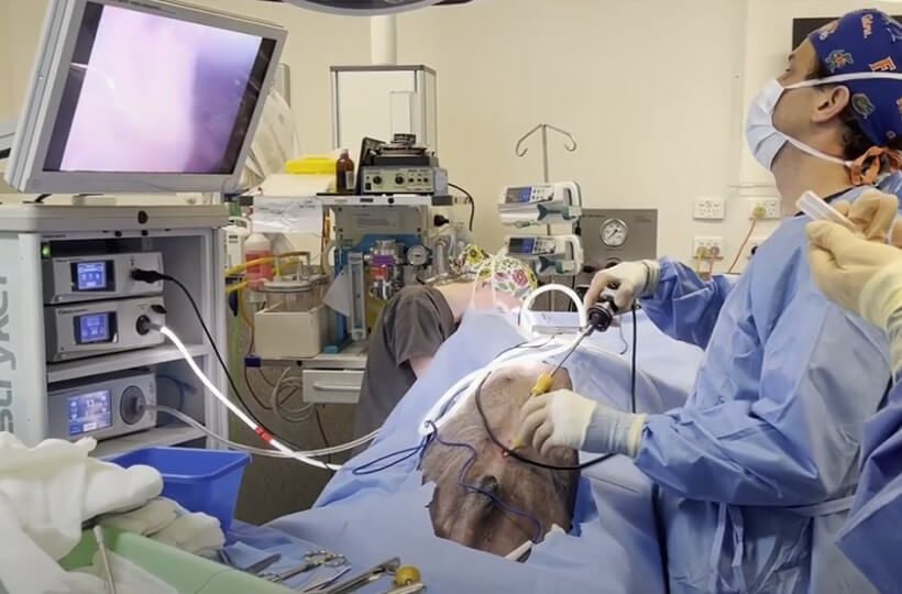 Laparoscopic Spay and Gastropexy