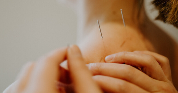 Acupuncture for cancer-related pain