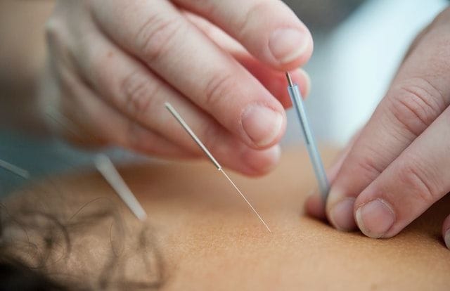 Acupuncture and sexuality women with cancer