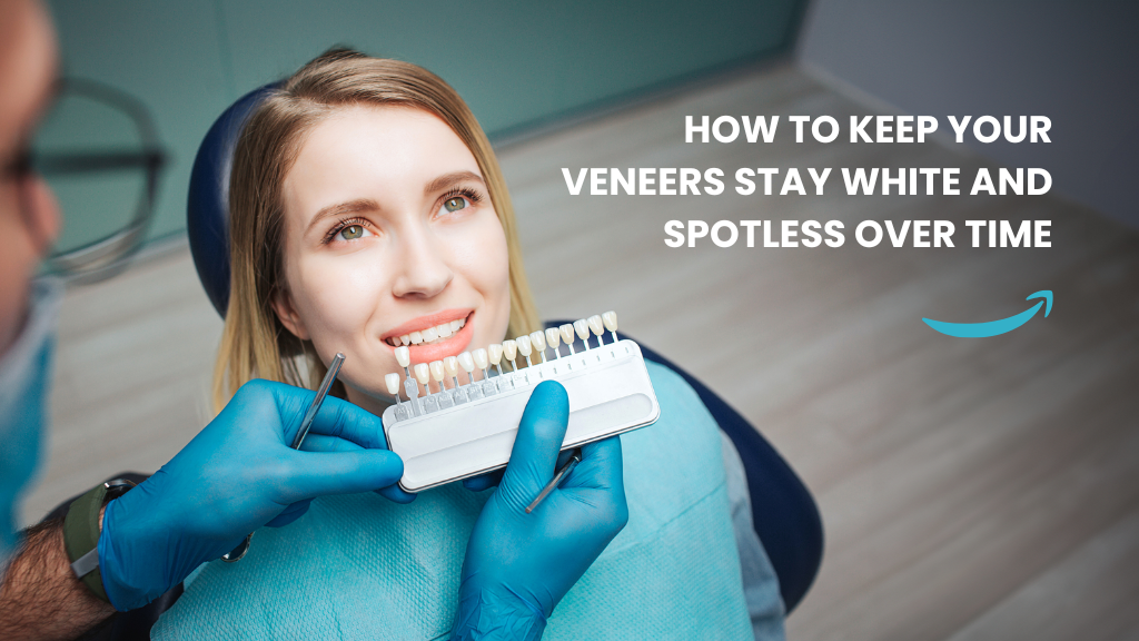 How to Keep Your Veneers Stay White and Spotless Over Time