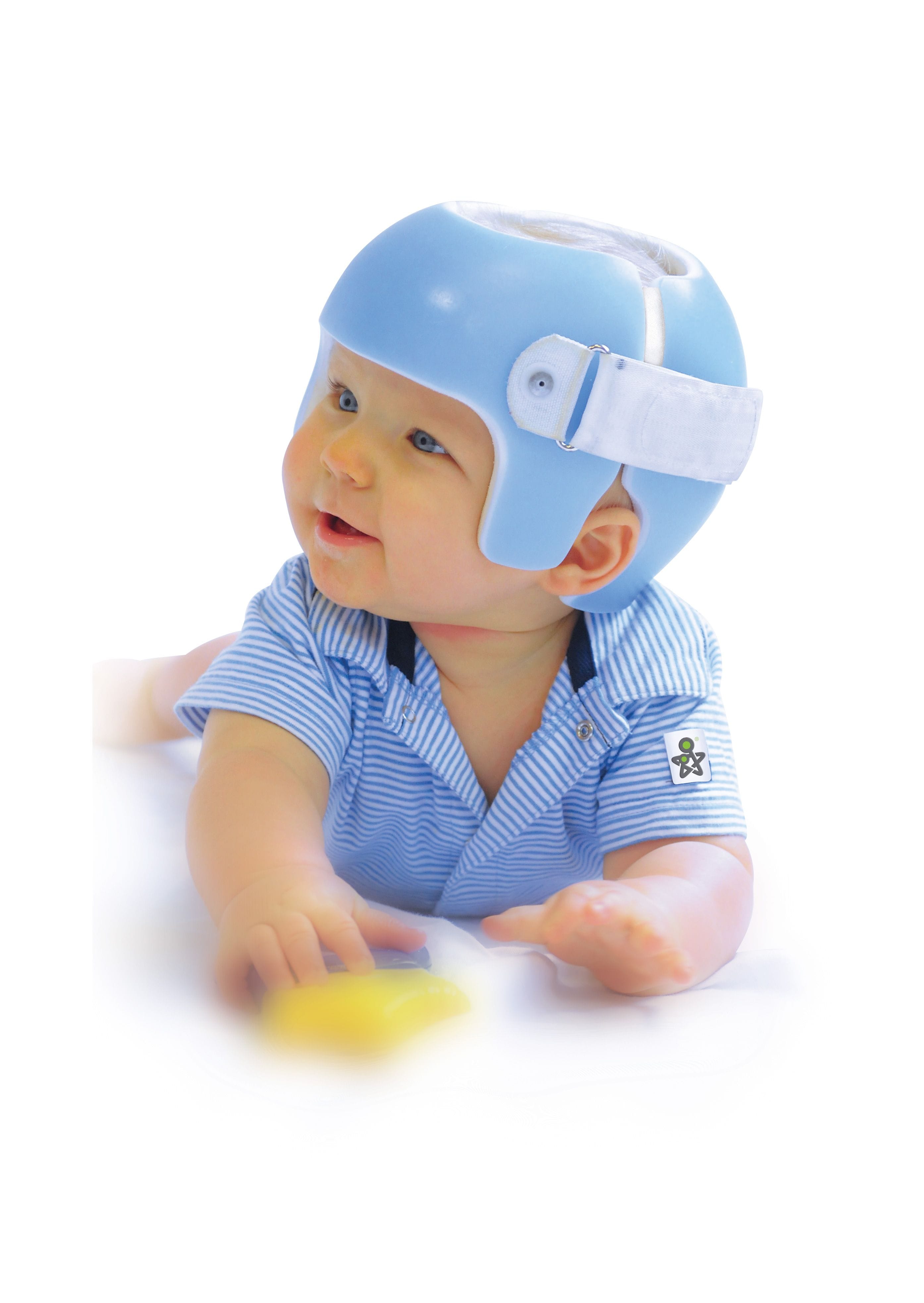 Plagiocephaly: Management of Baby Flat Head