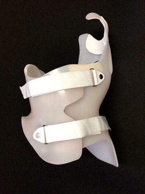 Boston Brace RC  Asymmetrical Custom Scoliosis Brace