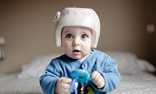 Custom-made pediatric helmets for plagiocephaly  | Orthobility Bracing