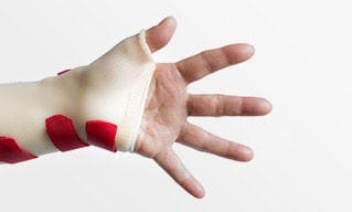 Custom hand and wrist splints | Orthobility Bracing