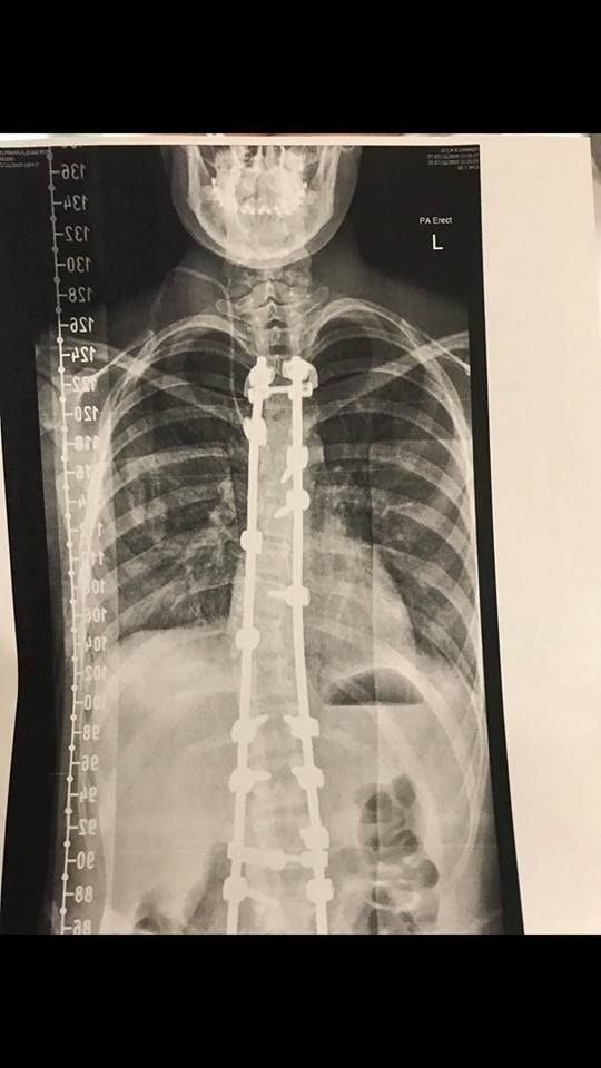 December 16th post operation visit 2018 December 16th post operation visit 2018