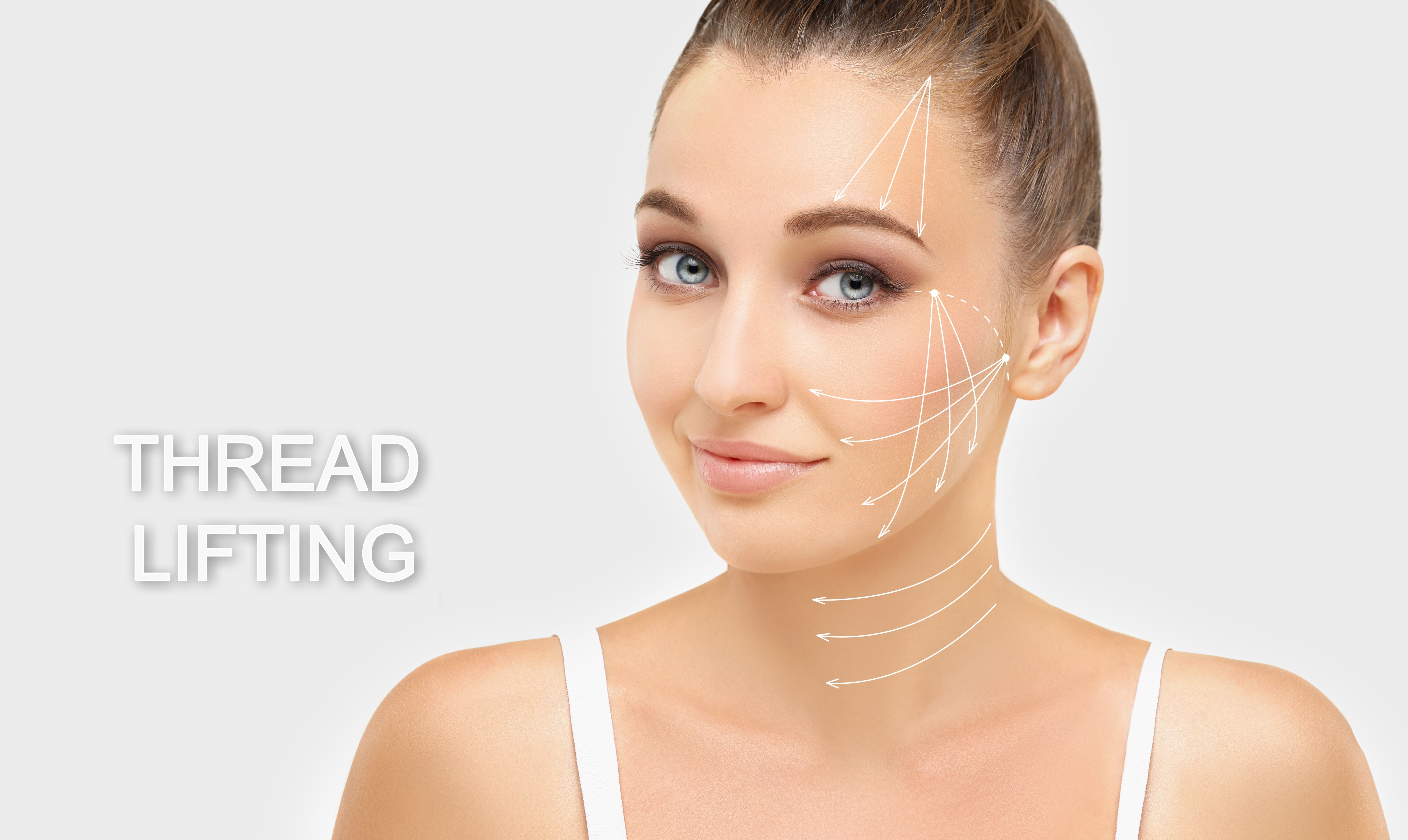 Thread Lifting in Facial Rejuvenation