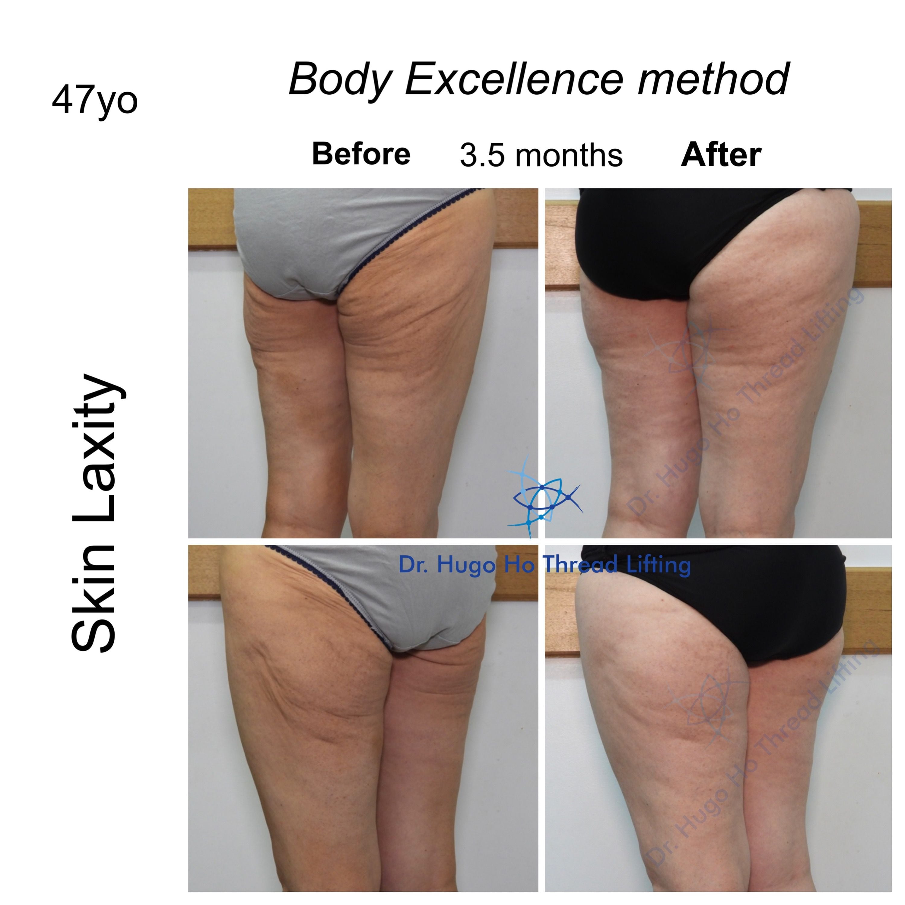 Body Image -60d05eb29fc6f