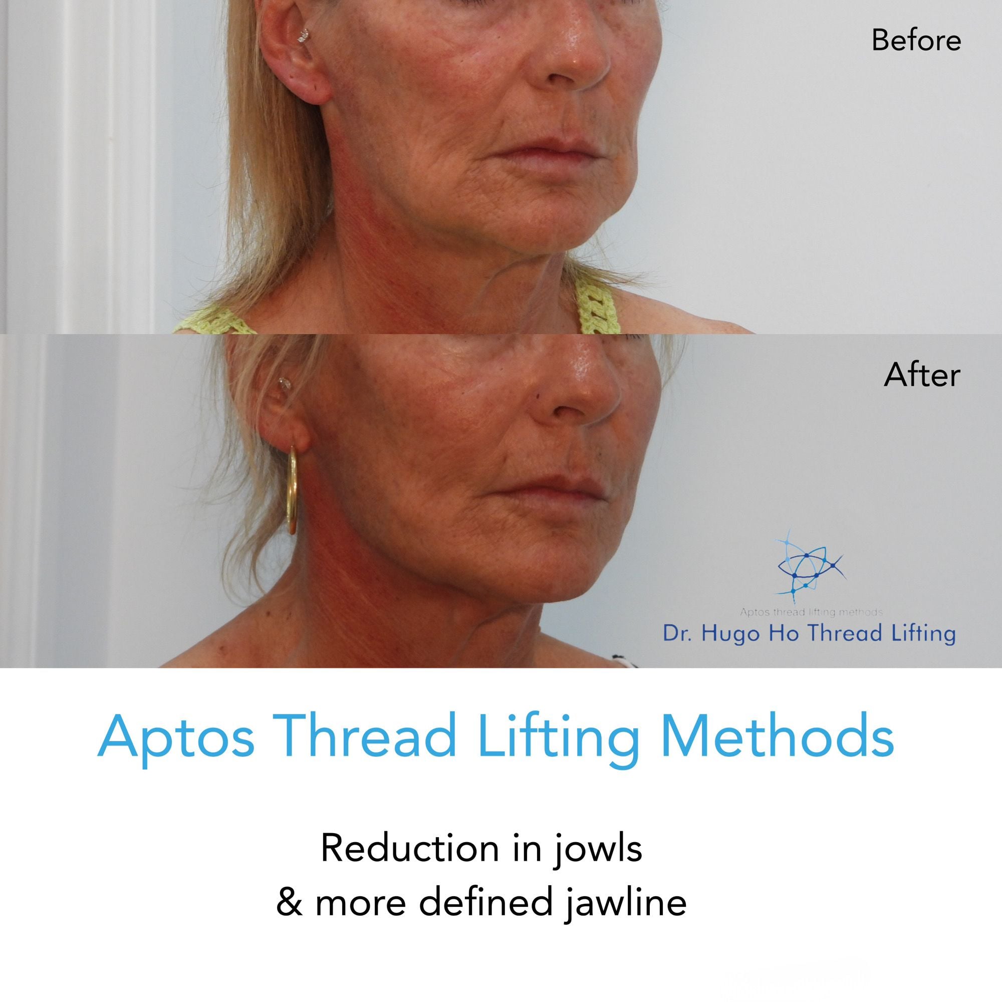 Face & Neck Image -6674dbac91a27