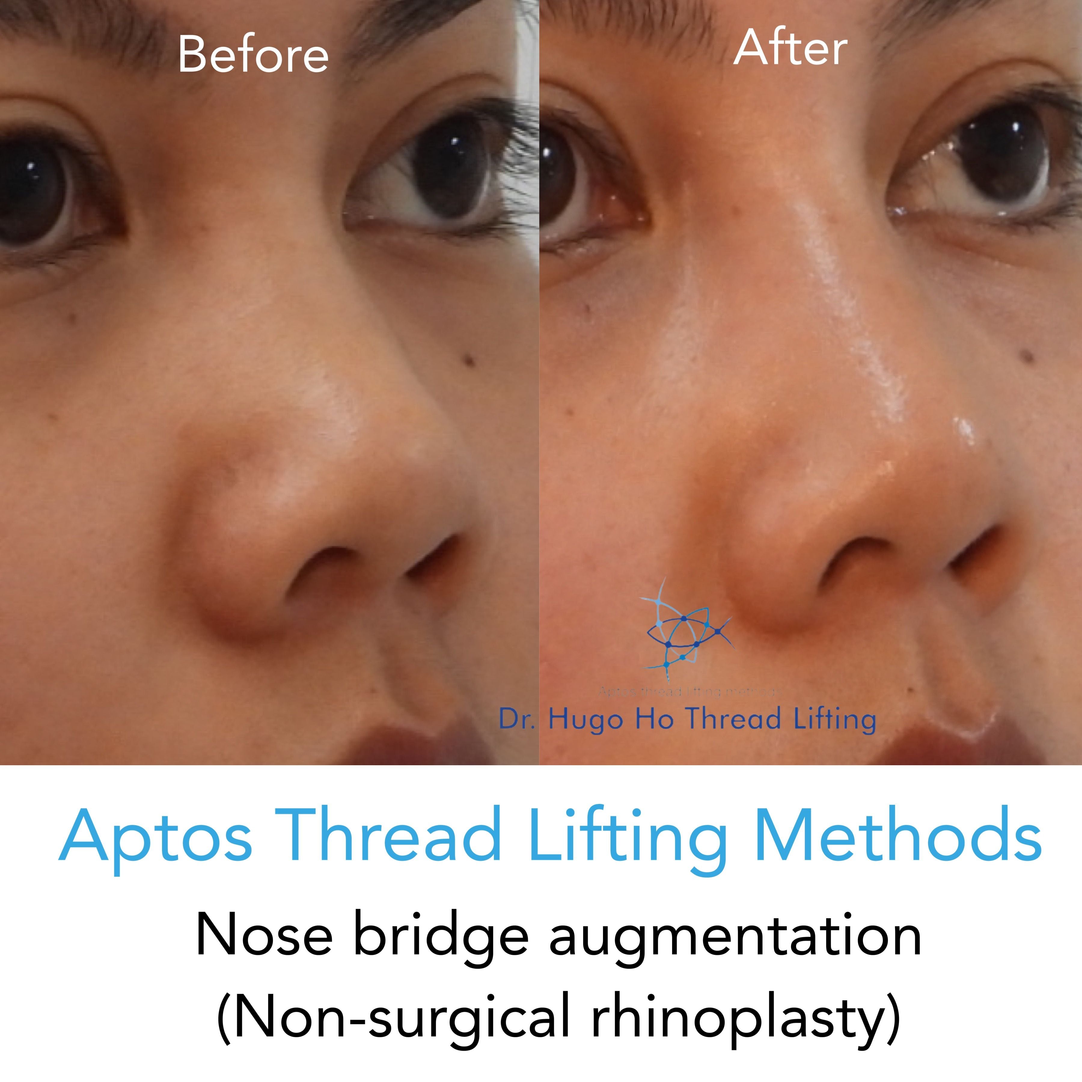 Face & Neck Image -6674dbaebb35d