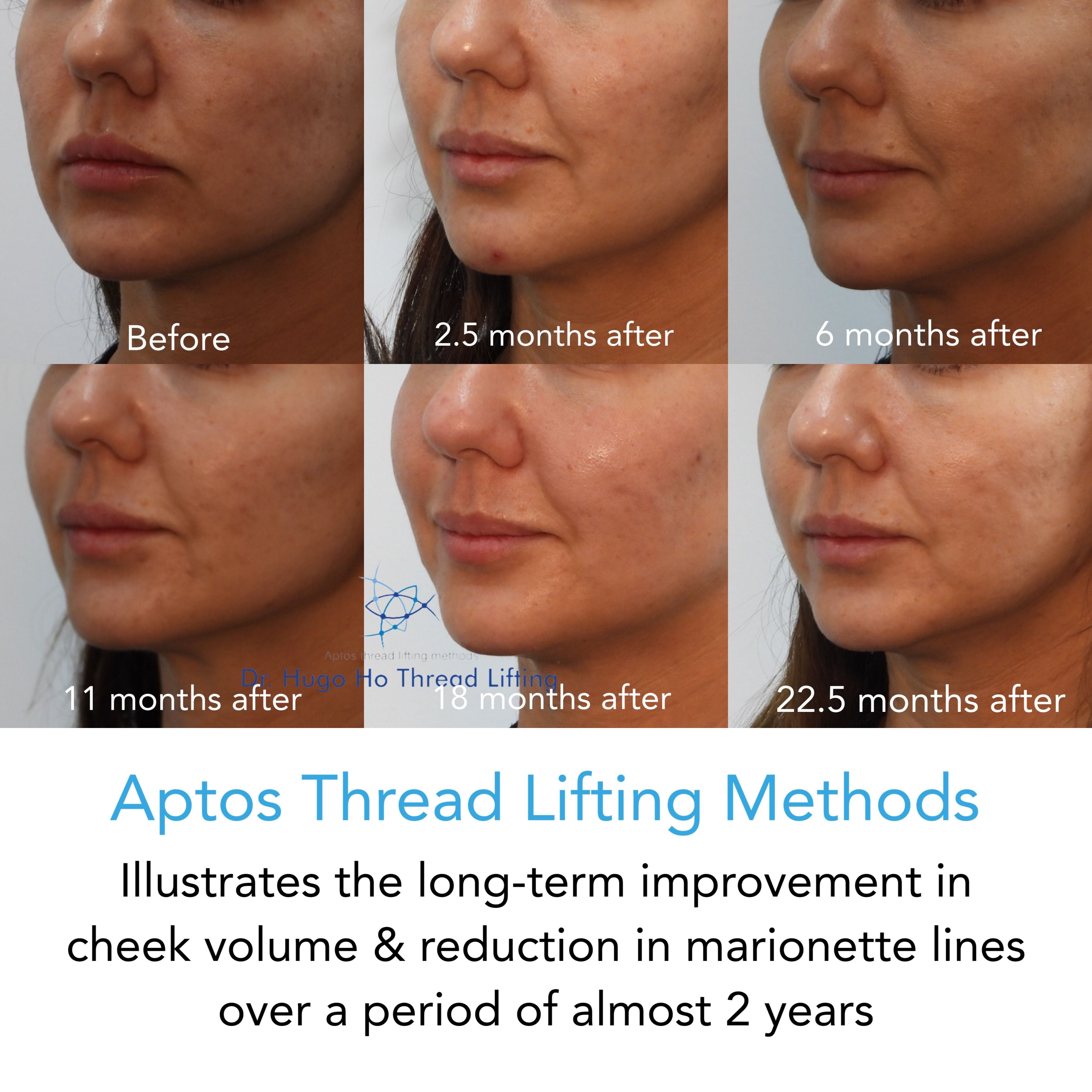 Face & Neck Image -6674dbaf8f2d7