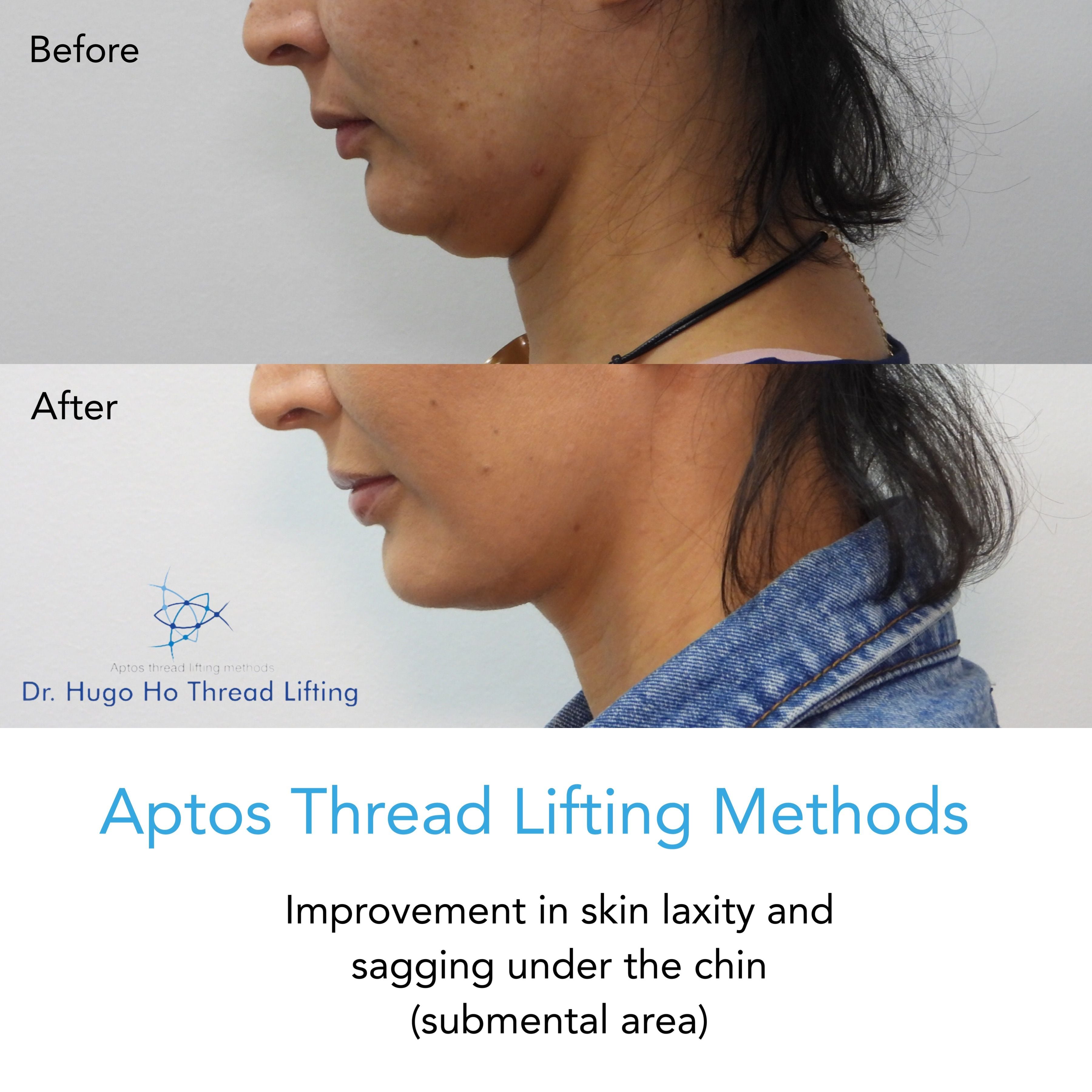 Face & Neck Image -6674dbb125a02