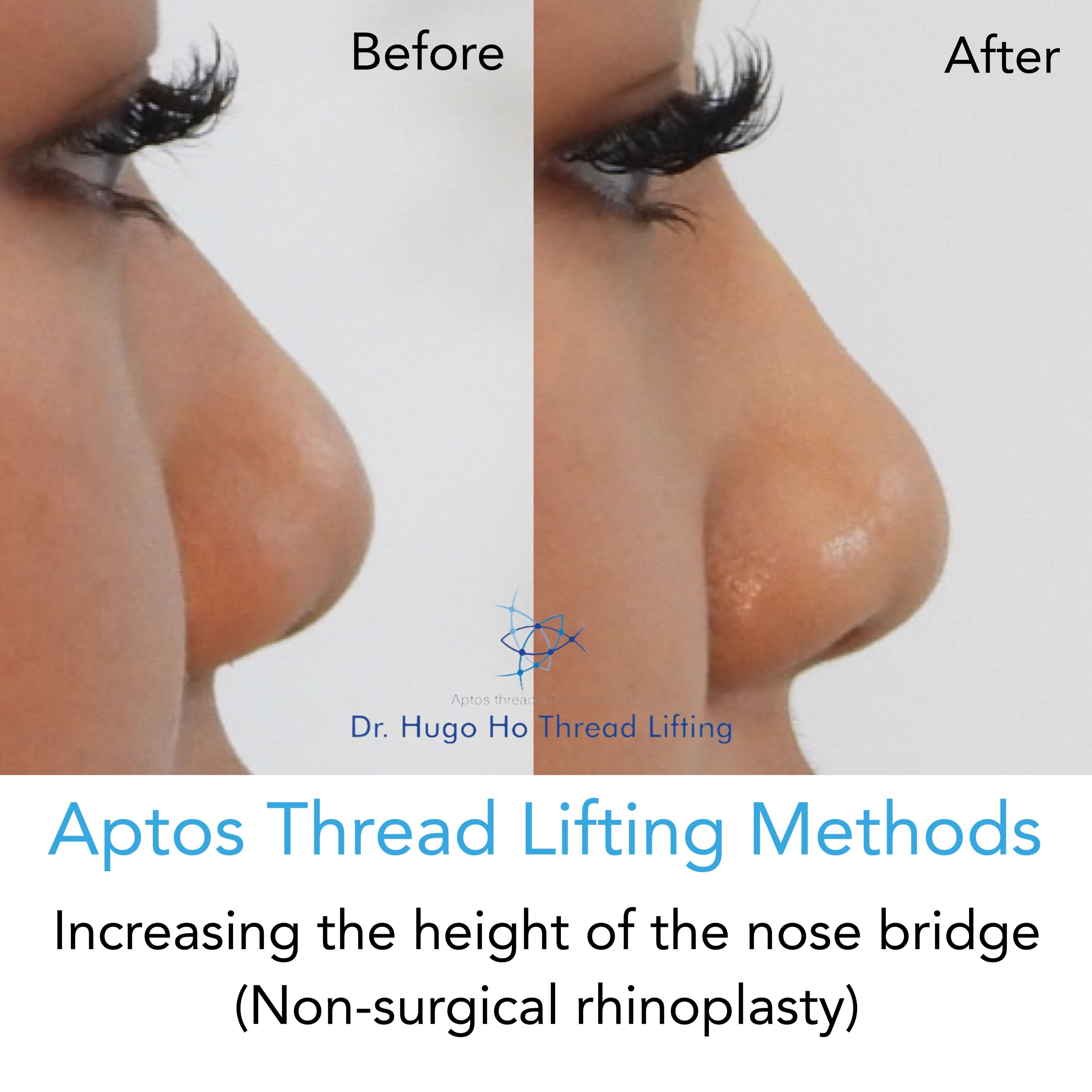 Face & Neck Image -6674dbb1c3a3f