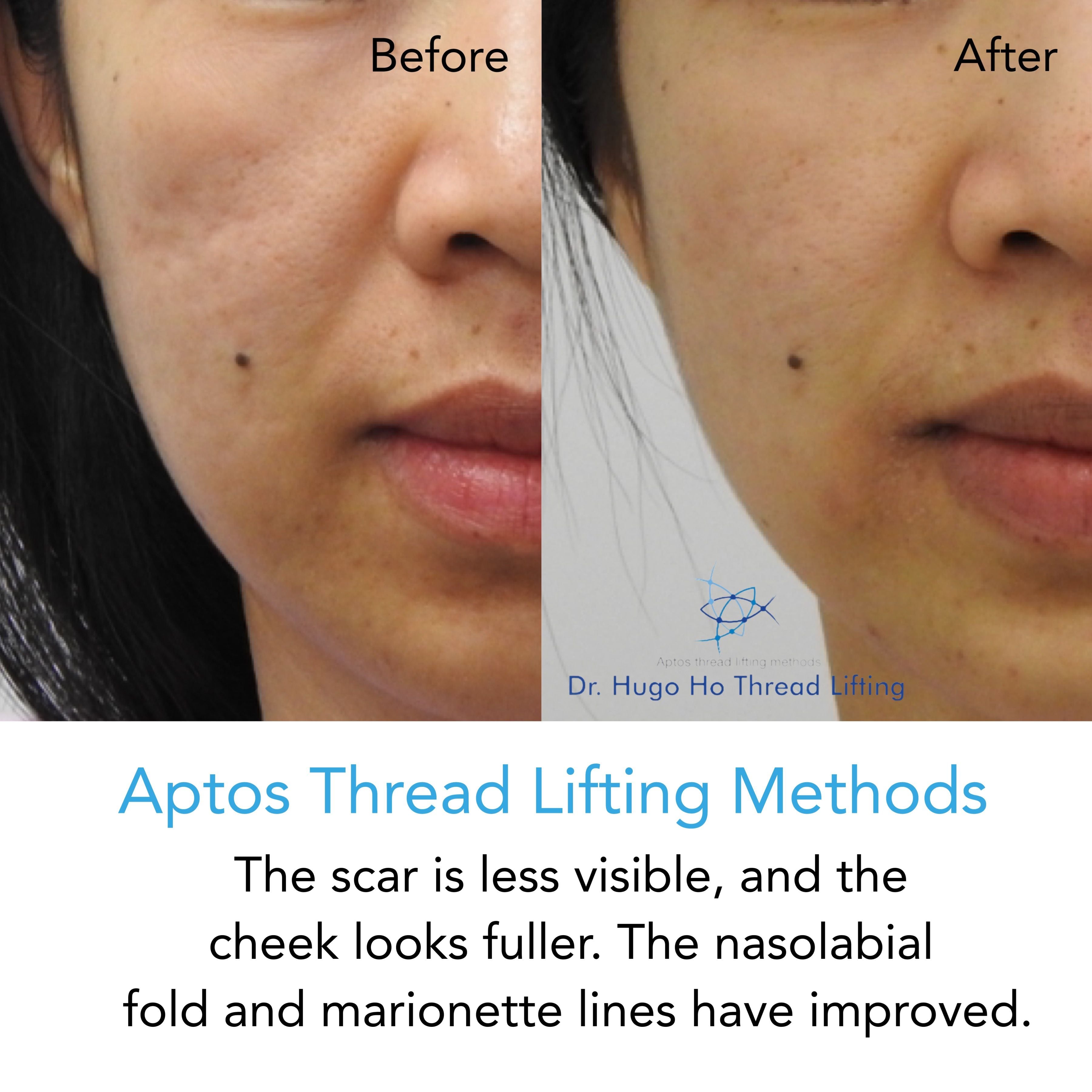 Face & Neck Image -6674dbb29518d