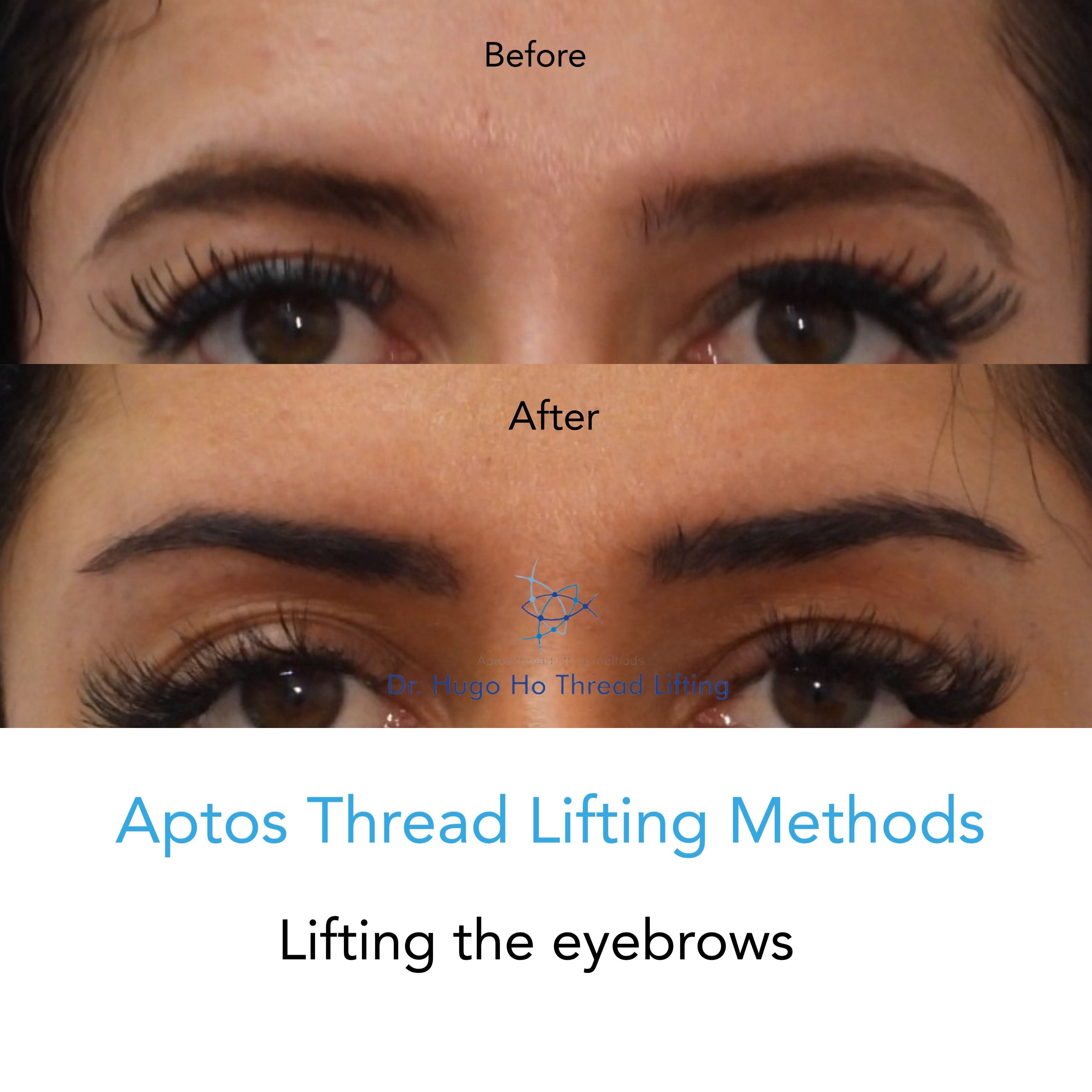 Face & Neck Image -6674dbb3ecf8c