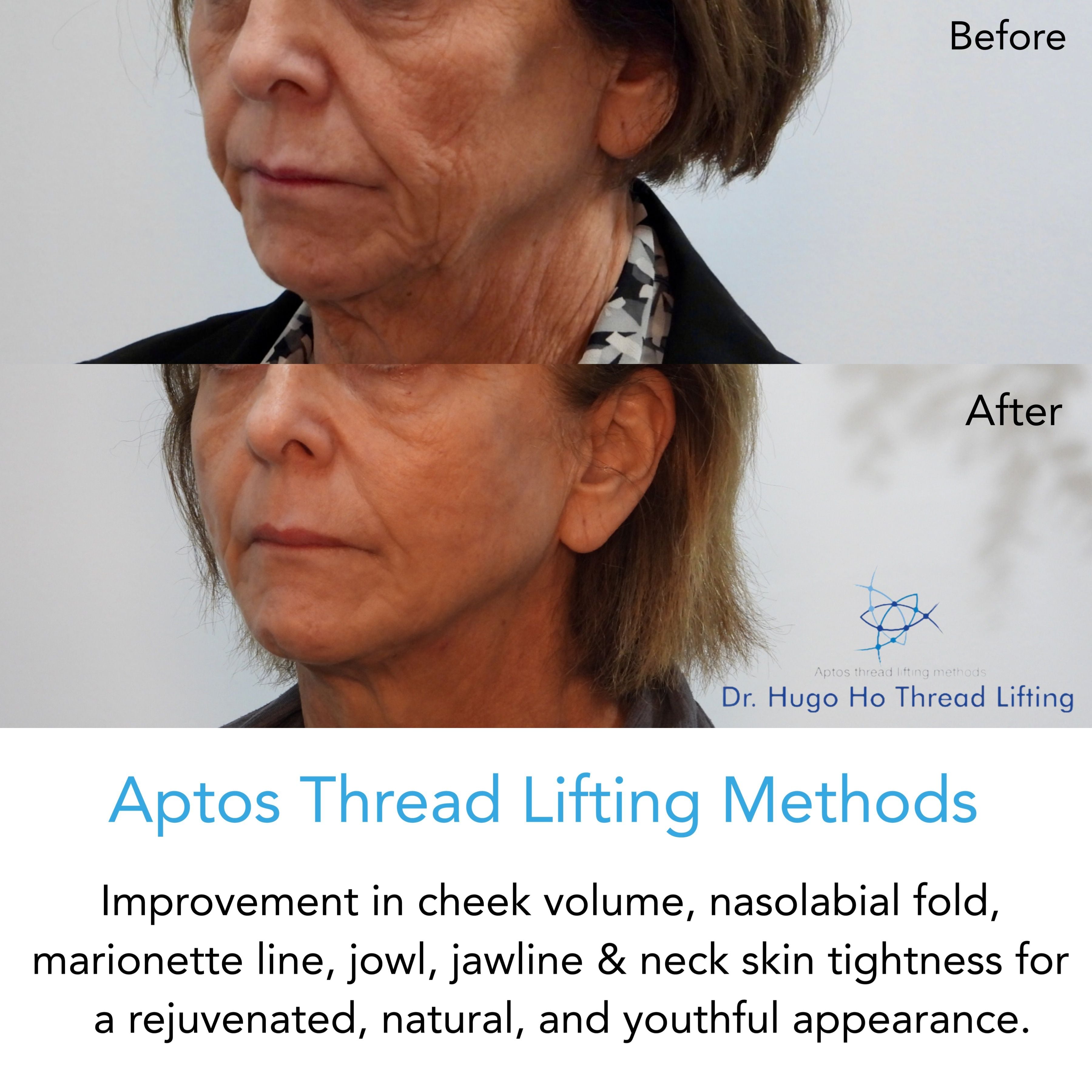 Face & Neck Image -6674dbb4c6a46