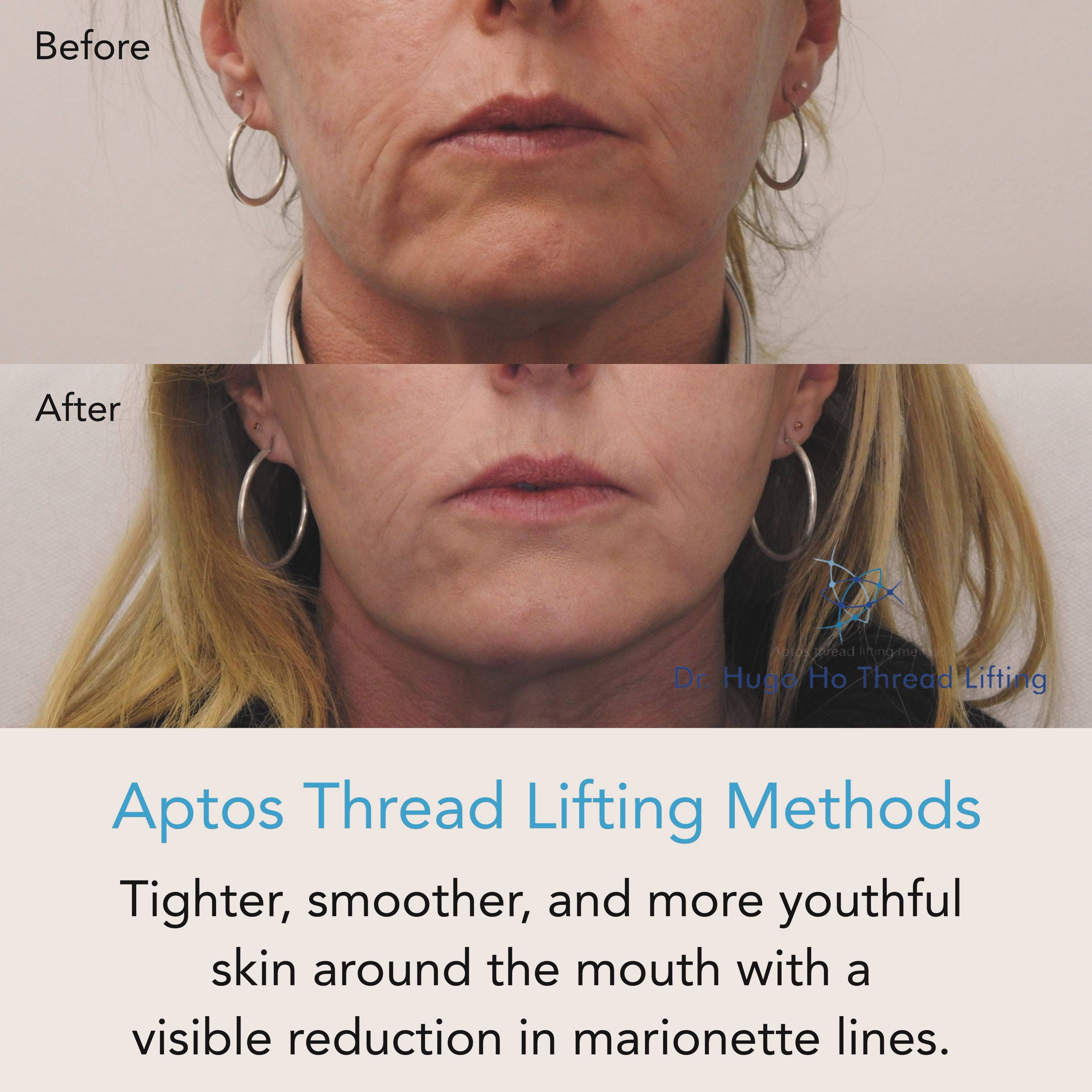 Face & Neck Image -6674dbb685108