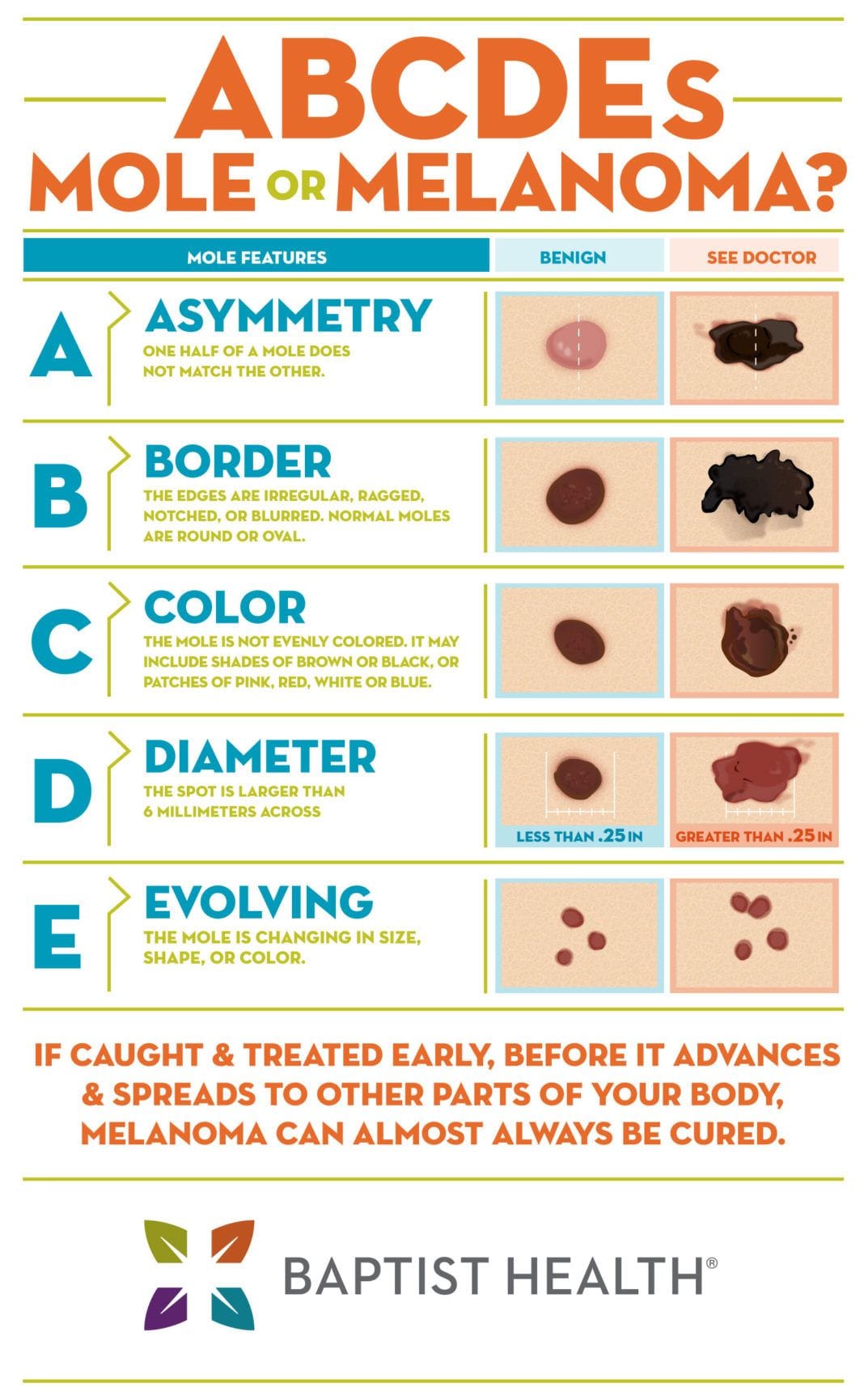 Infographic showing the different signs of skin cancer or suspicious moles 