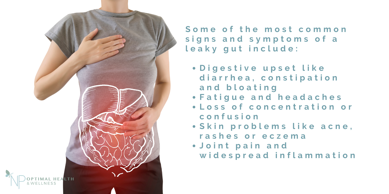 Some of the most common signs and symptoms of a leaky gut include: digestive upset, fatigue and headaches, loss of concentration, skin conditions and joint pain. 