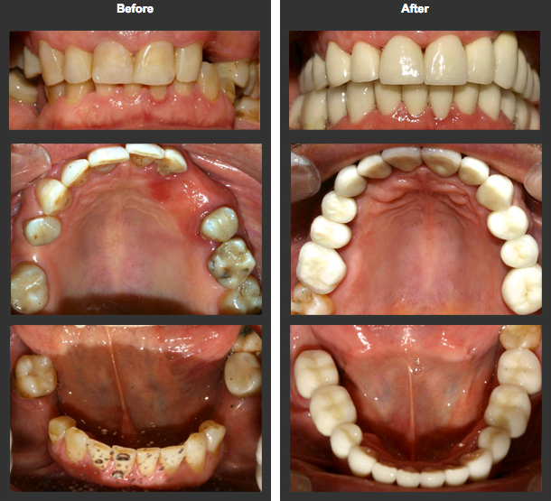 Before & After