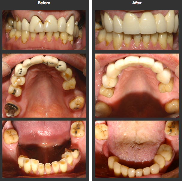 Before & After